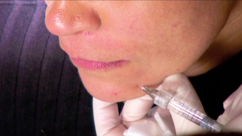 Captation et retransmissions chirurgie esthétiques
